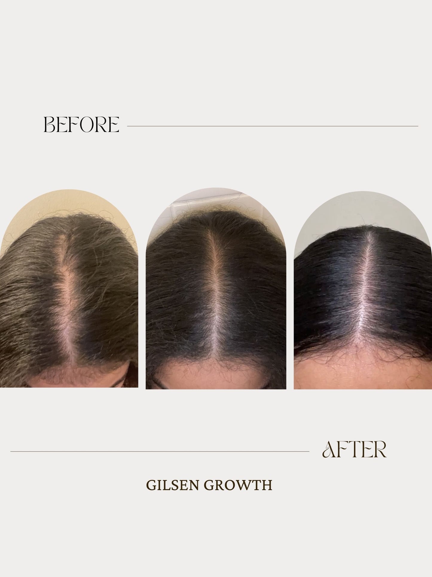 SCALP TREATMENT 2oz