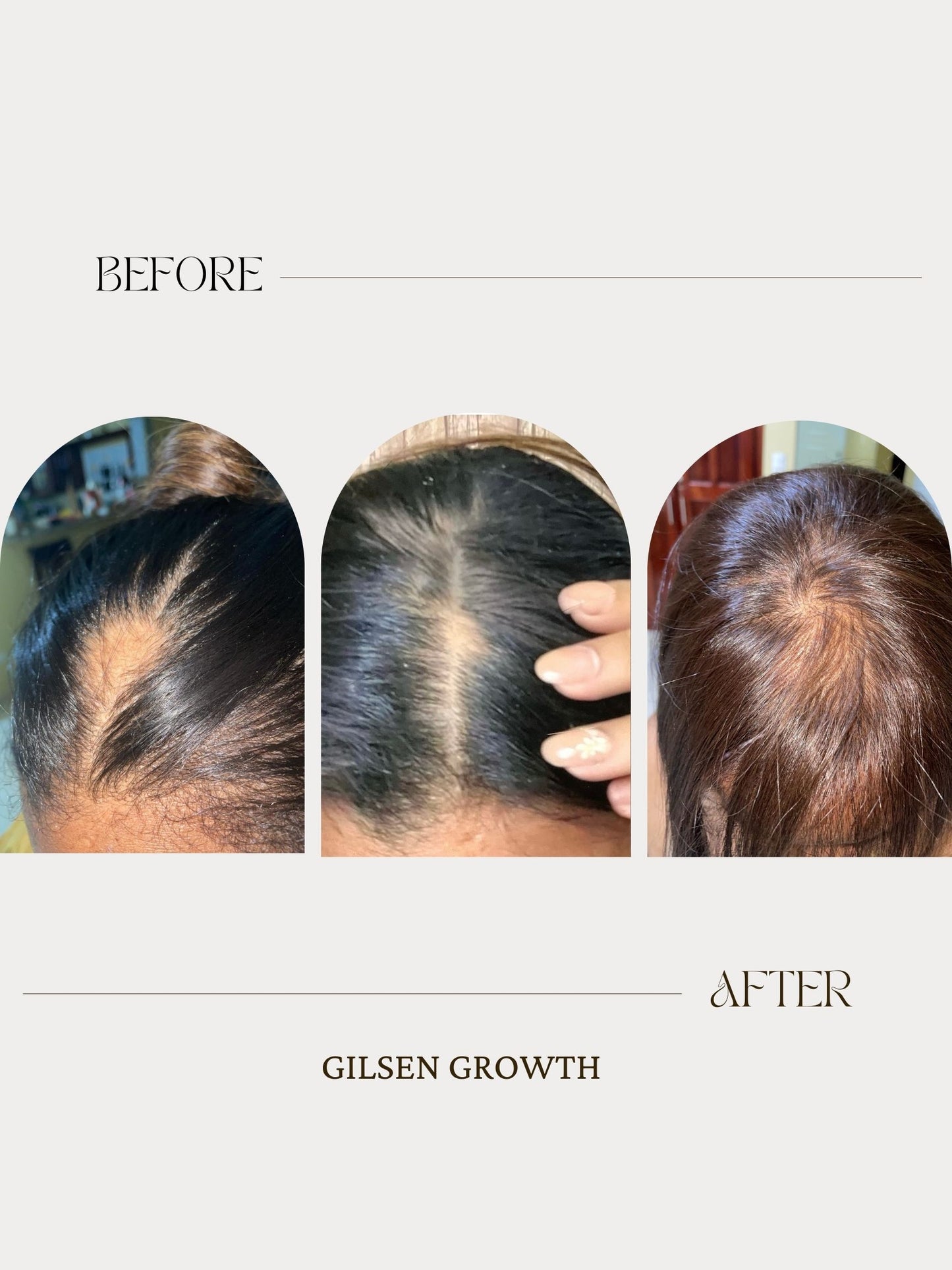 SCALP TREATMENT 2oz